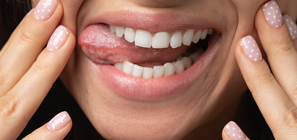 Remineralizacja szkliwa: Jak odbudować i wzmocnić zęby?